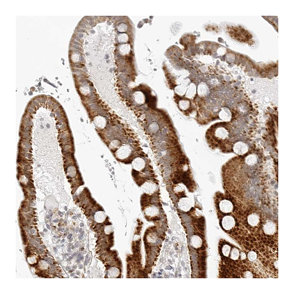 Atlas Antibodies Anti-RPS6KC1 Antibody