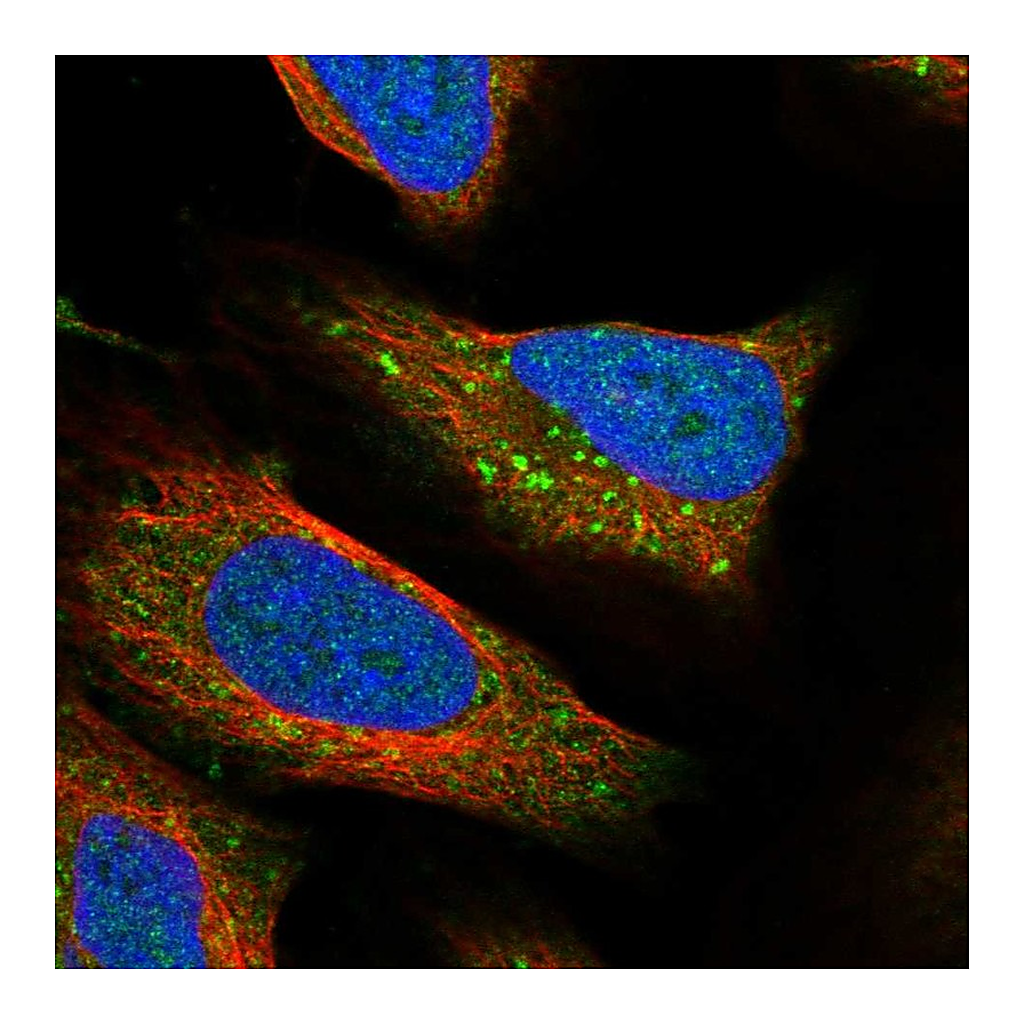 Atlas Antibodies Anti-RPTOR Antibody
