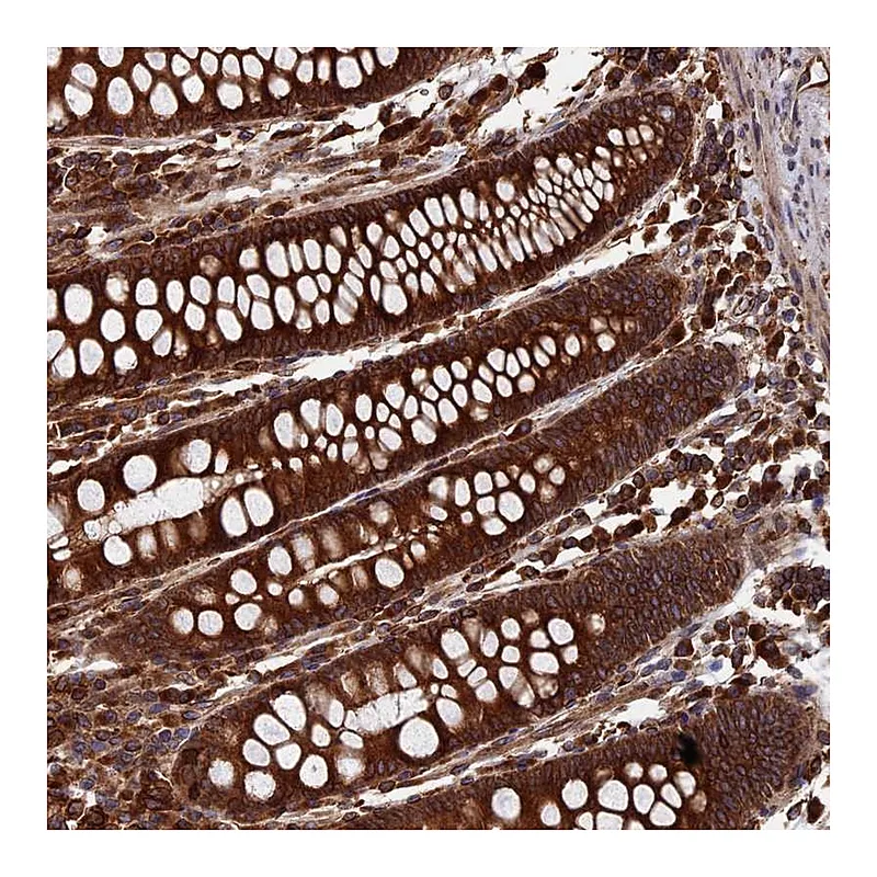 Atlas Antibodies Anti-RPUSD1 Antibody