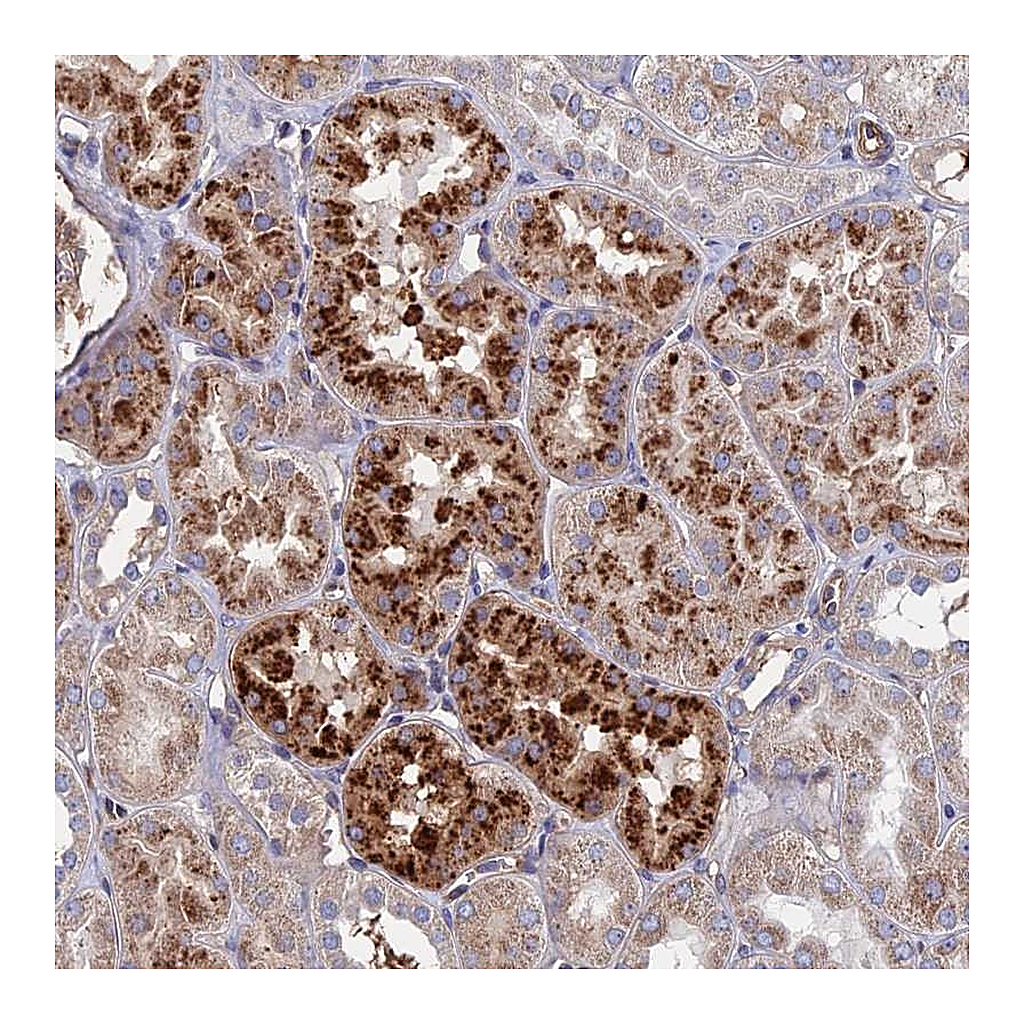 Atlas Antibodies Anti-RPUSD1 Antibody