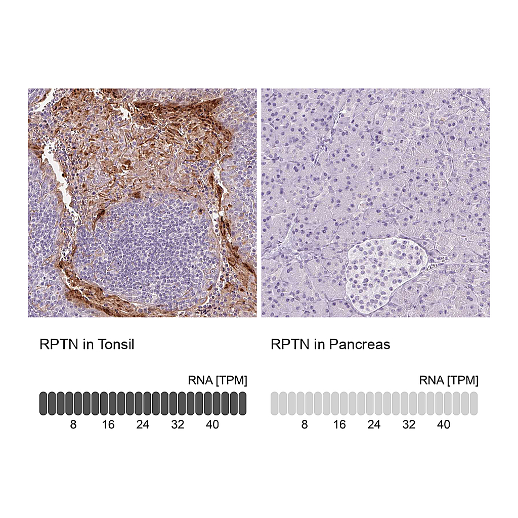 Atlas Antibodies Anti-RPTN Antibody