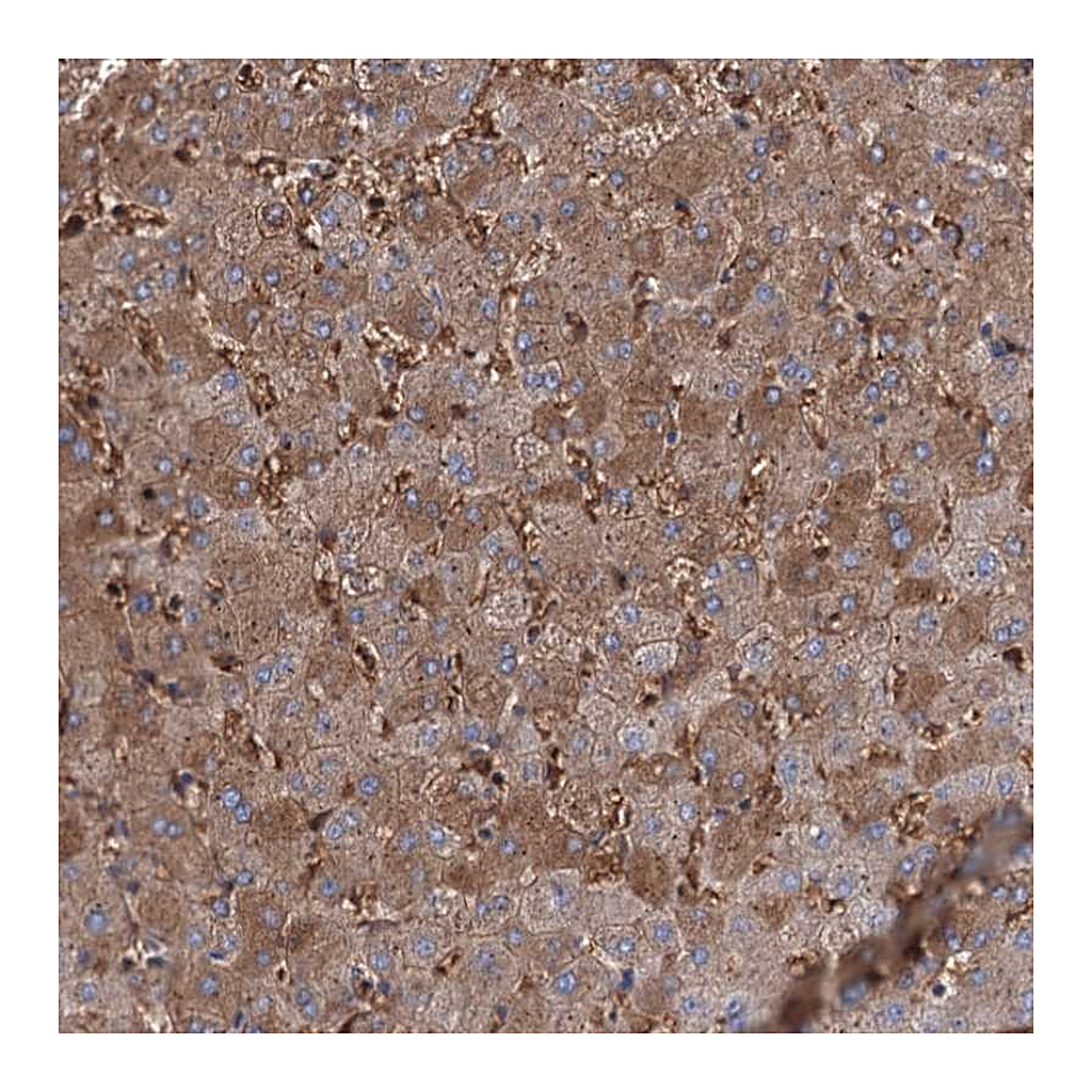 Atlas Antibodies Anti-RPUSD3 Antibody