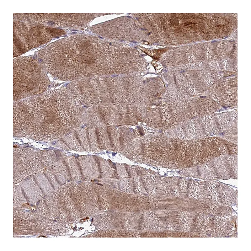 Atlas Antibodies Anti-RRAD Antibody