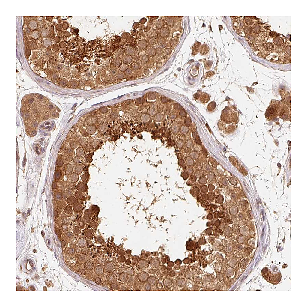 Atlas Antibodies Anti-RRAS2 Antibody