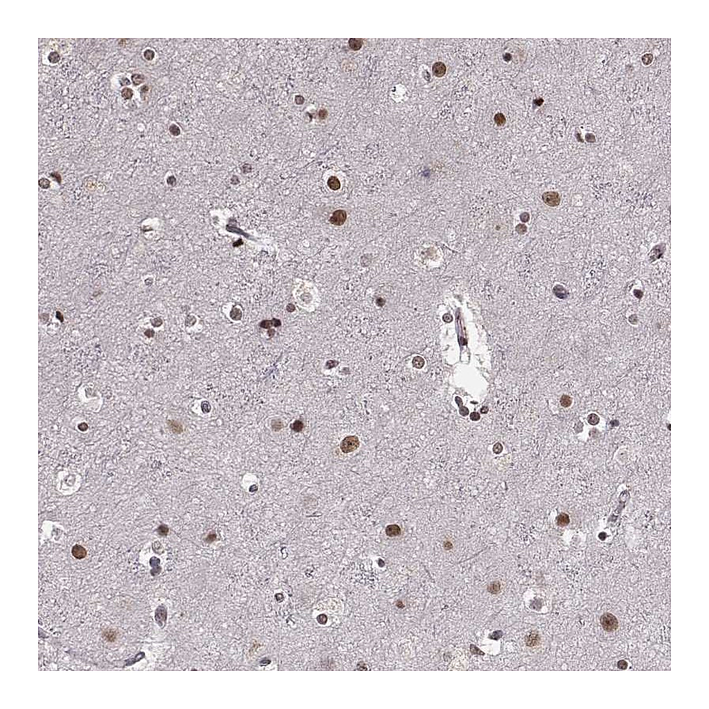Atlas Antibodies Anti-RRAGD Antibody