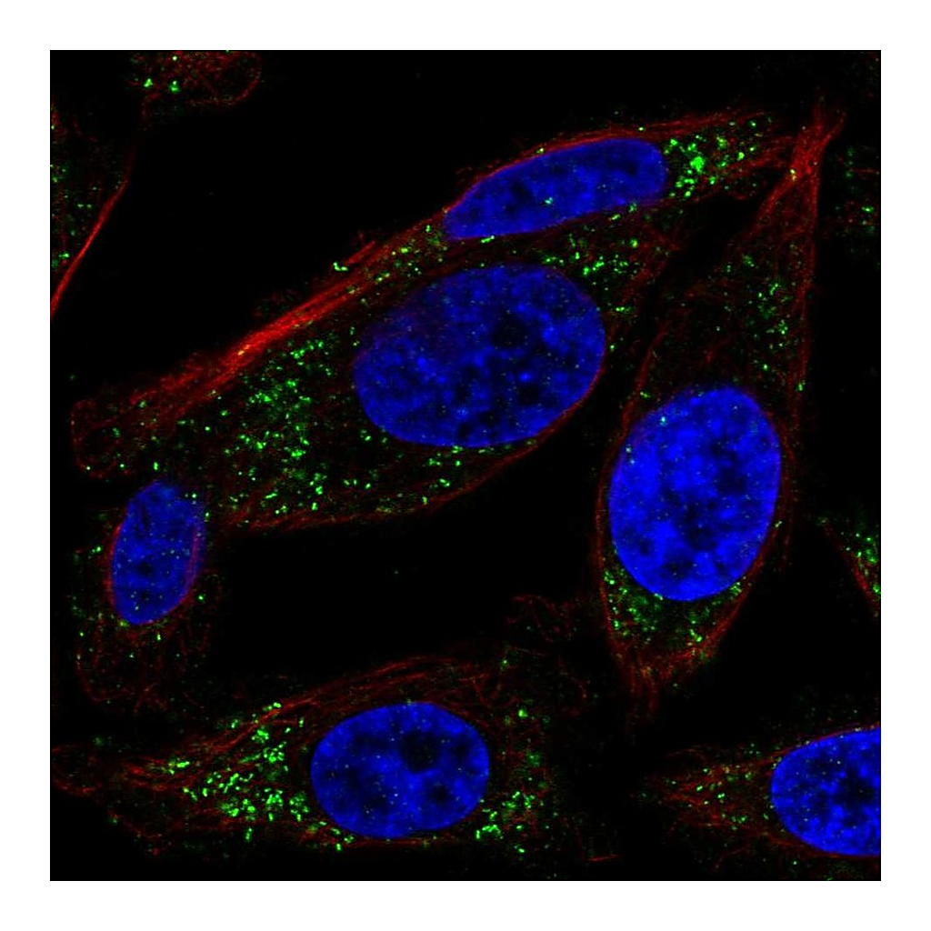 Atlas Antibodies Anti-RRAS Antibody