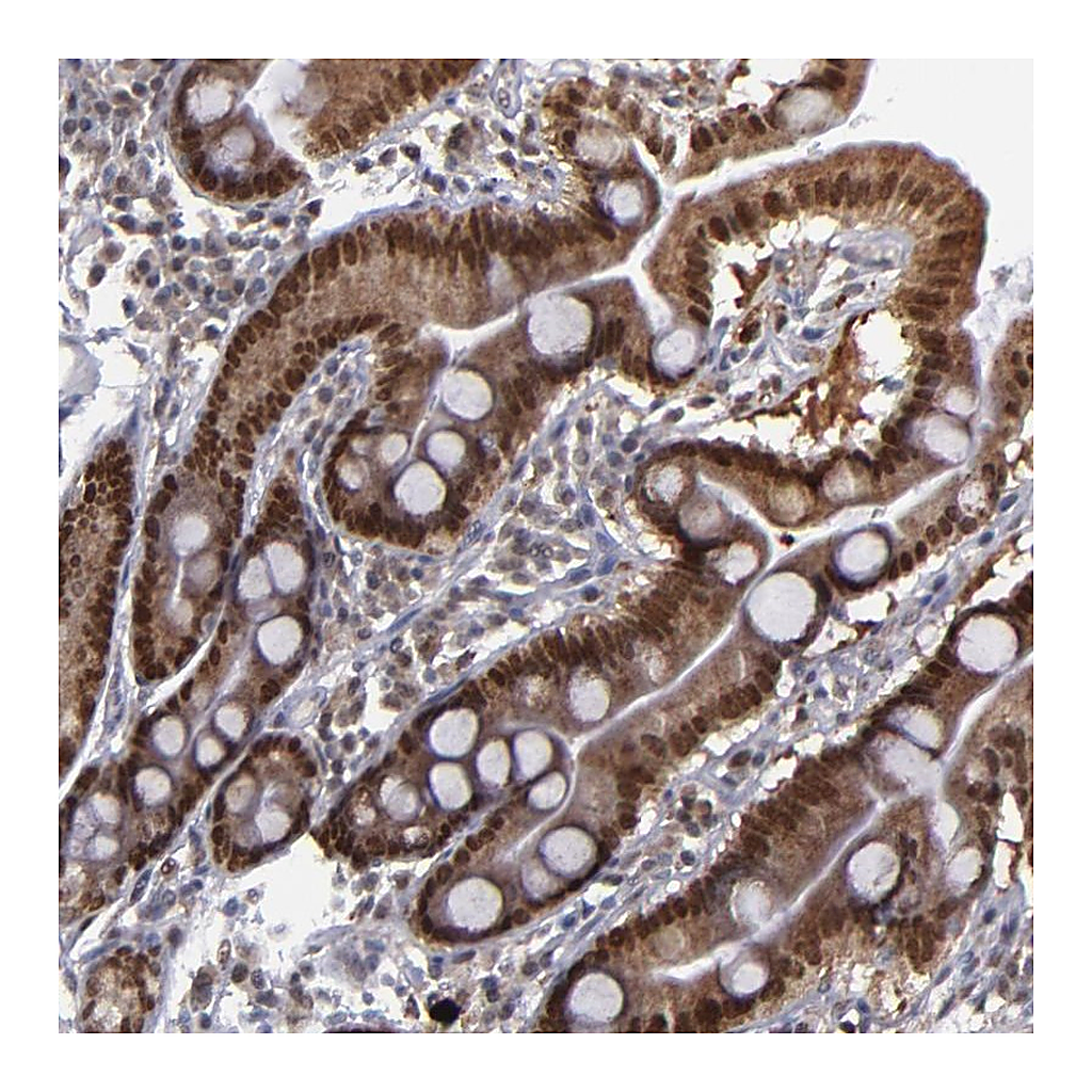 Atlas Antibodies Anti-RREB1 Antibody