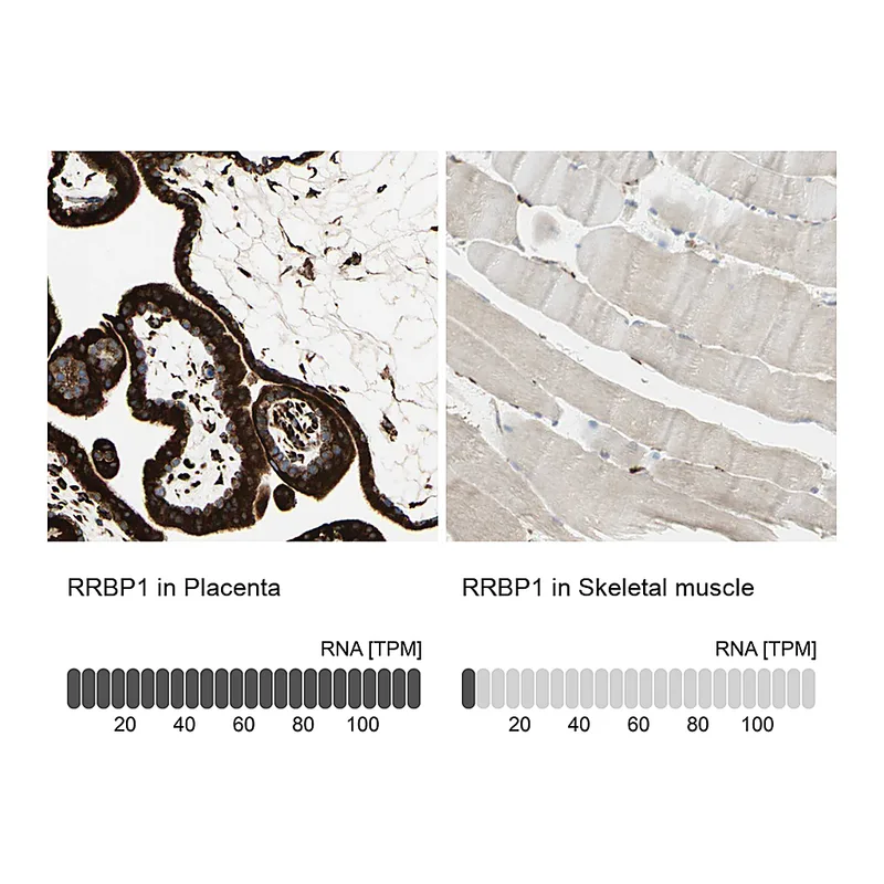 Atlas Antibodies Anti-RRBP1 Antibody