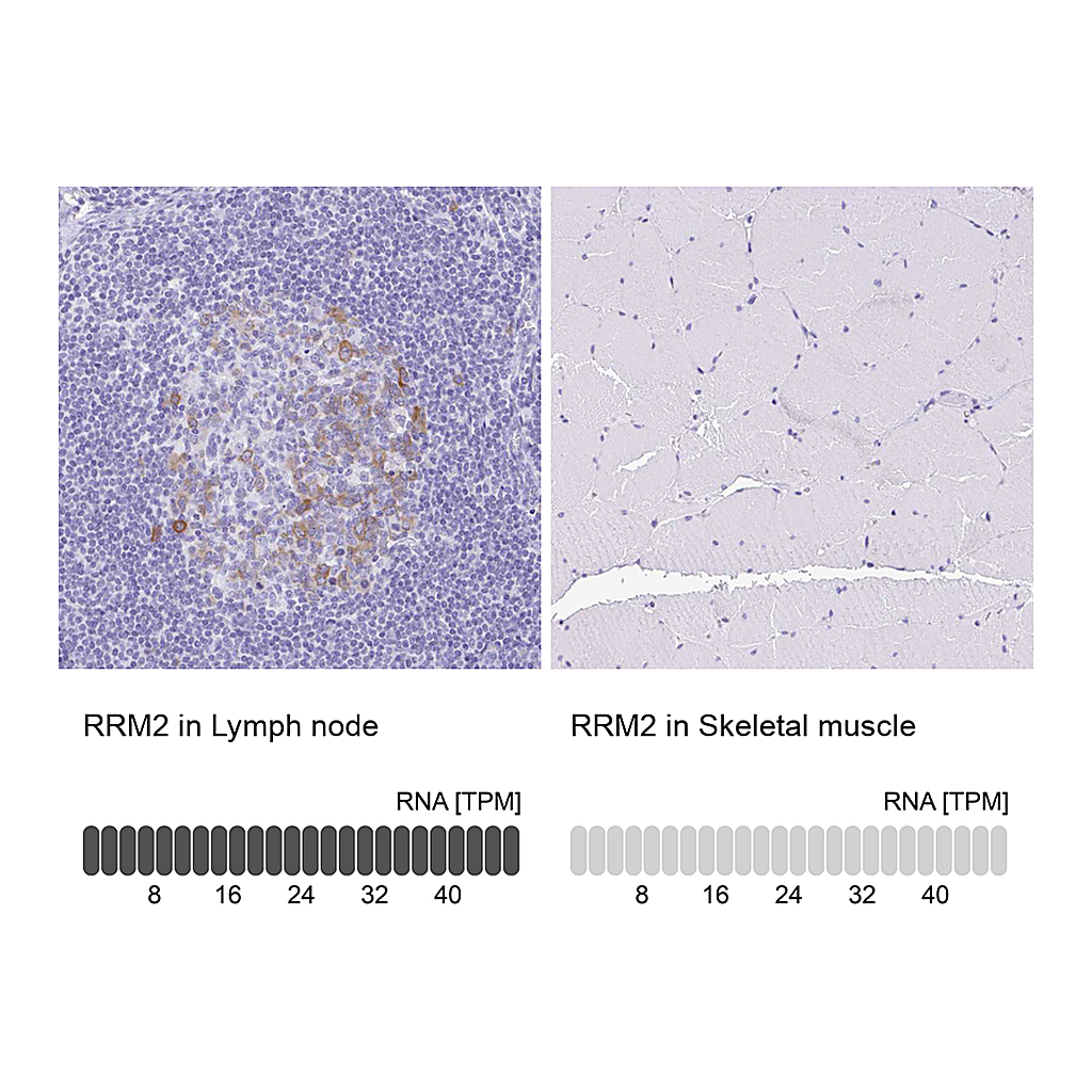 Atlas Antibodies Anti-RRM2 Antibody