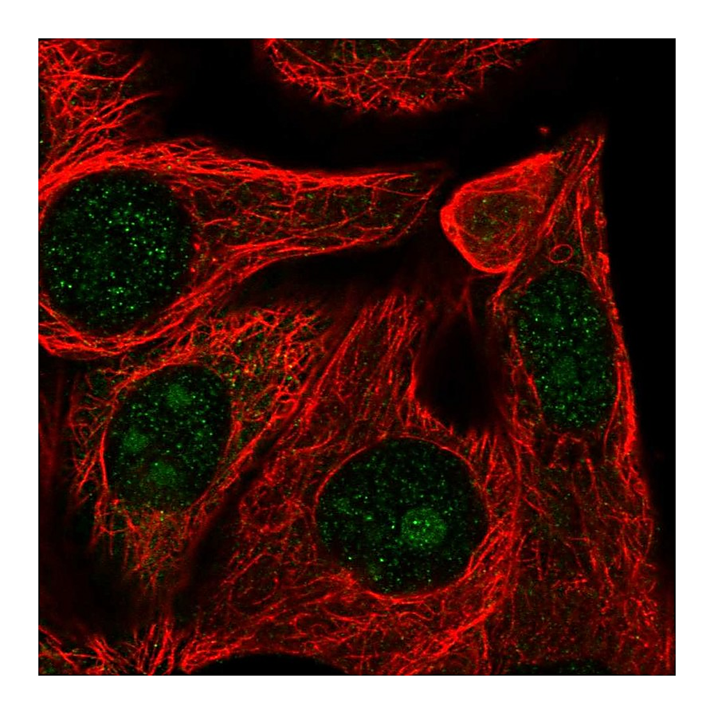 Atlas Antibodies Anti-RRP12 Antibody