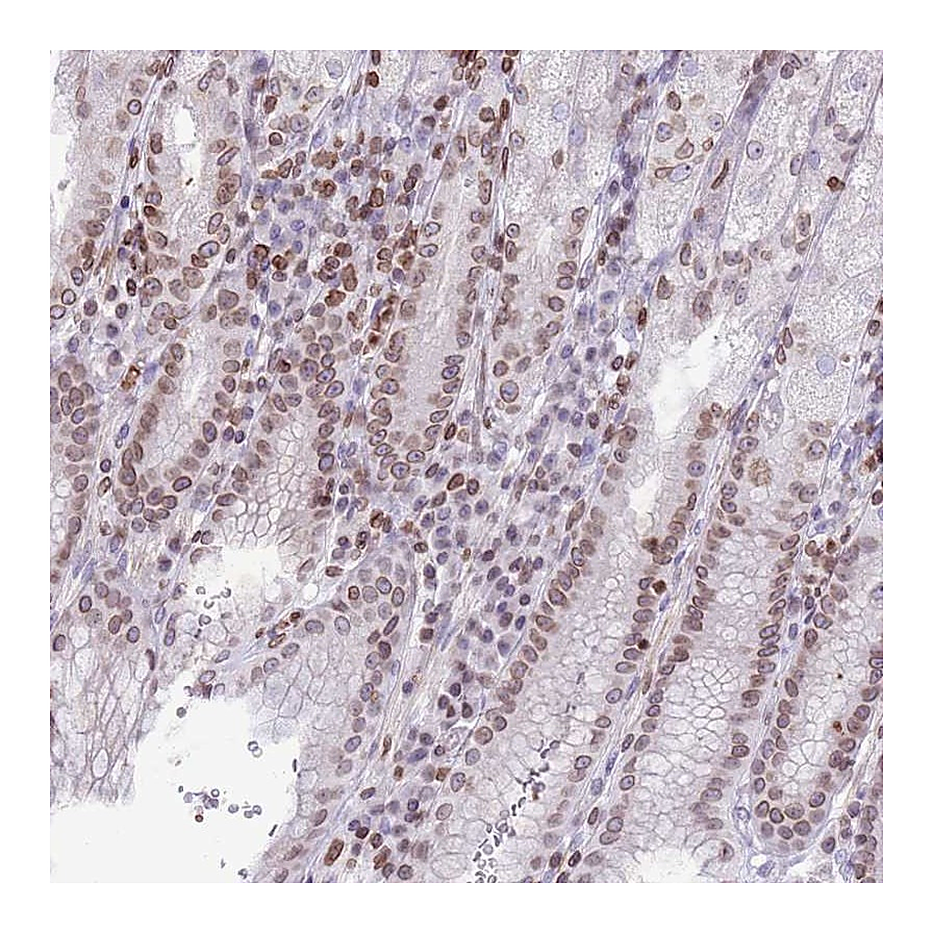 Atlas Antibodies Anti-RRNAD1 Antibody