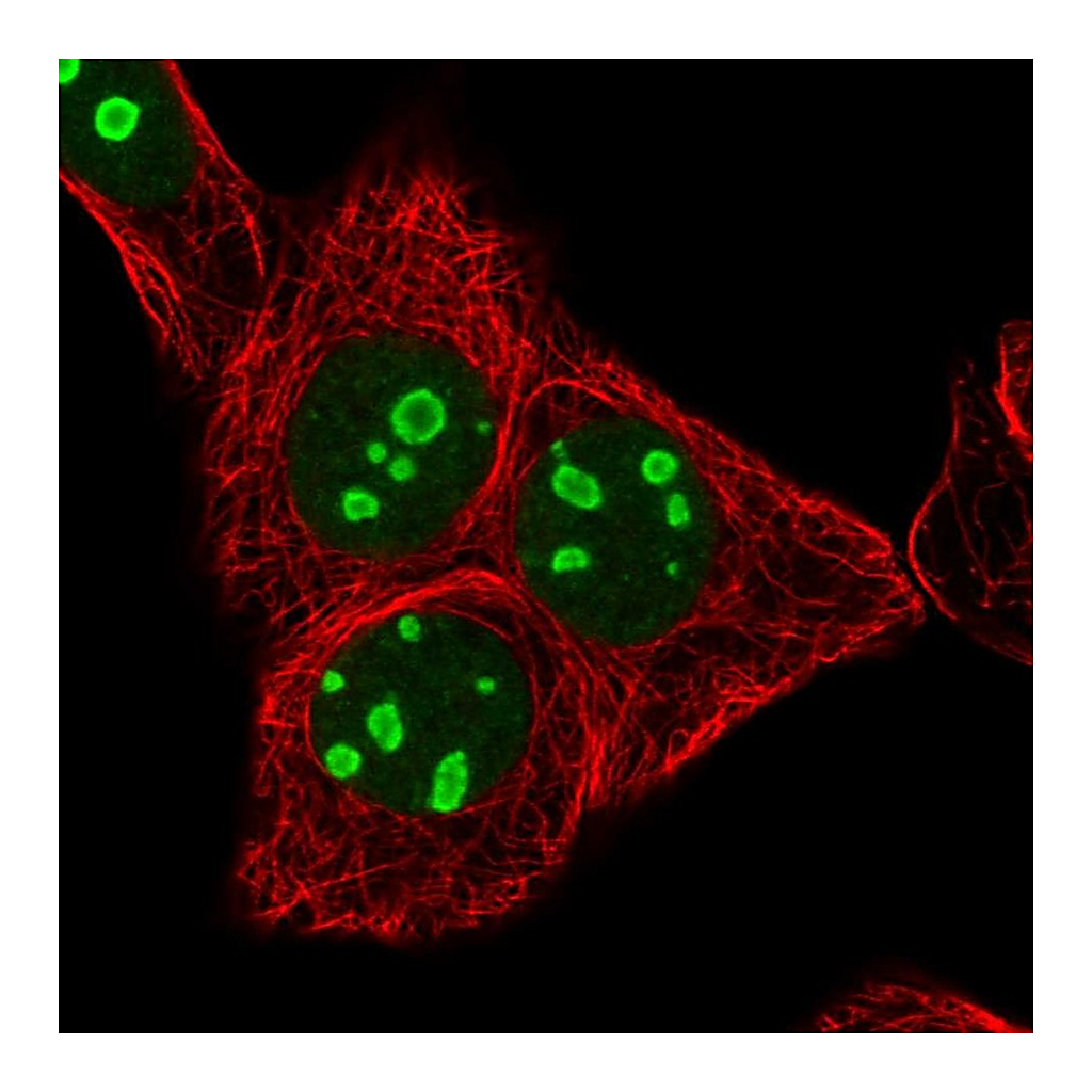 Atlas Antibodies Anti-RRN3 Antibody