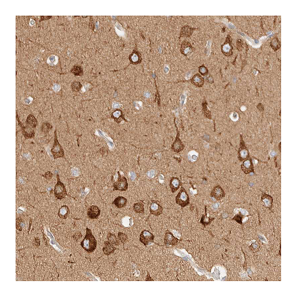 Atlas Antibodies Anti-RRP15 Antibody