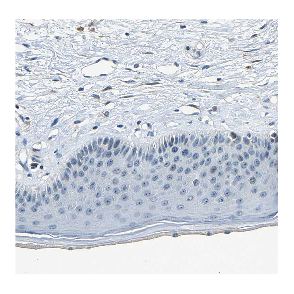 Atlas Antibodies Anti-RRP1 Antibody