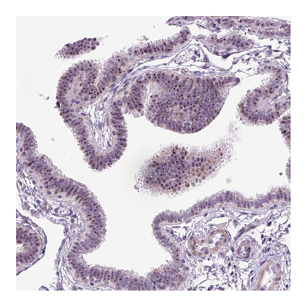 Atlas Antibodies Anti-RRS1 Antibody
