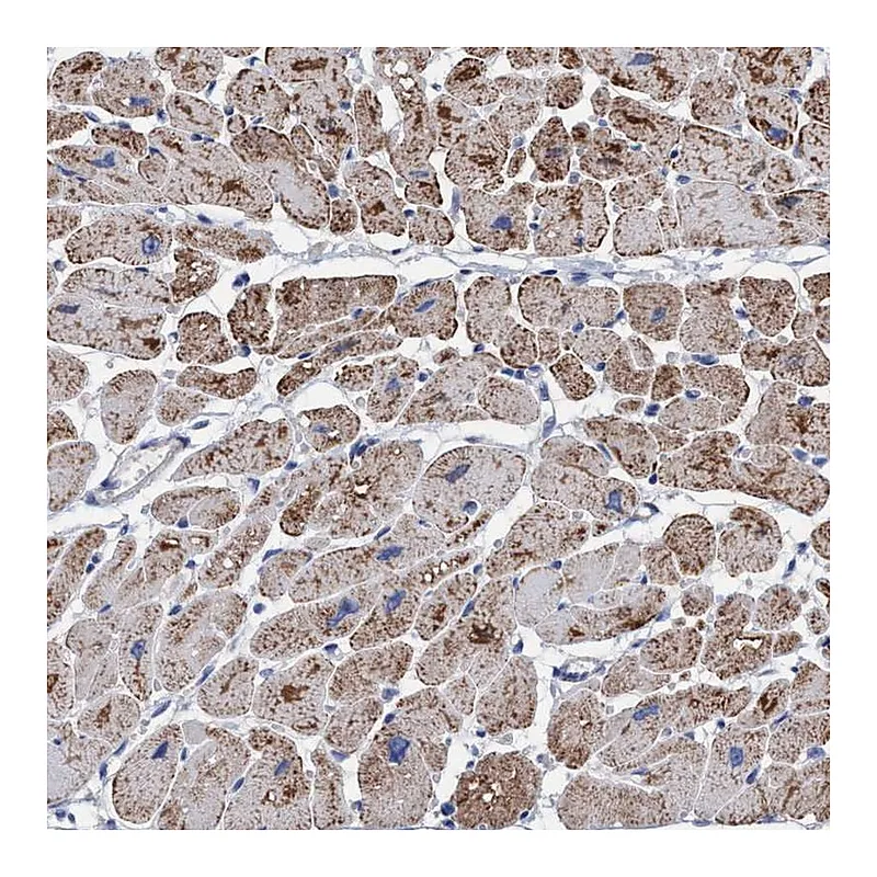 Atlas Antibodies Anti-RSAD1 Antibody
