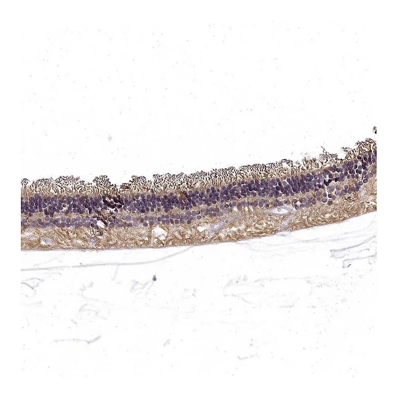 Atlas Antibodies Anti-RS1 Antibody