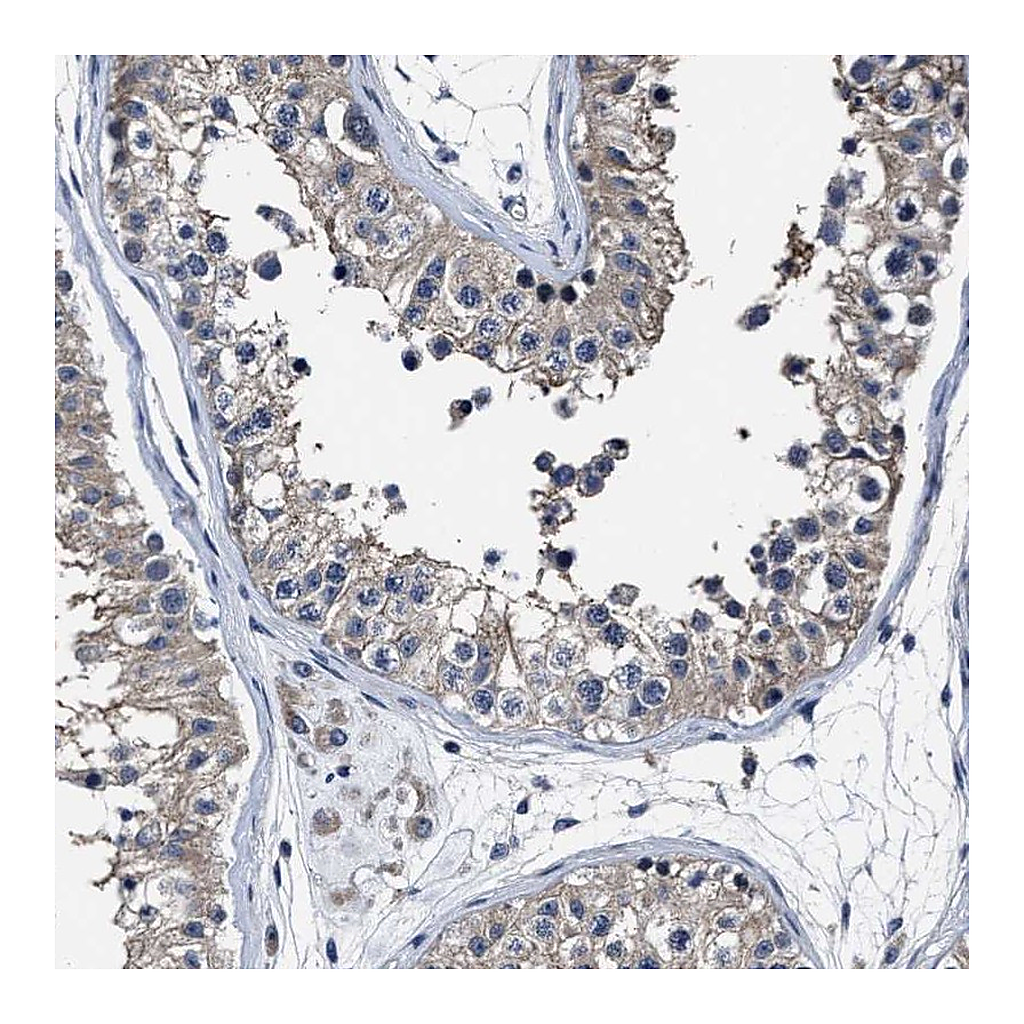 Atlas Antibodies Anti-RSBN1L Antibody