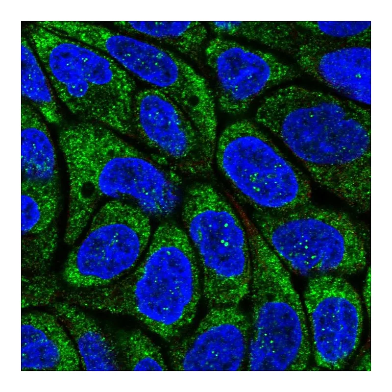 Atlas Antibodies Anti-RSAD2 Antibody