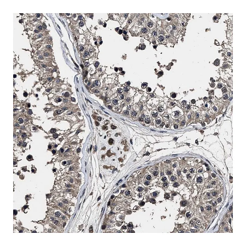 Atlas Antibodies Anti-RSBN1L Antibody