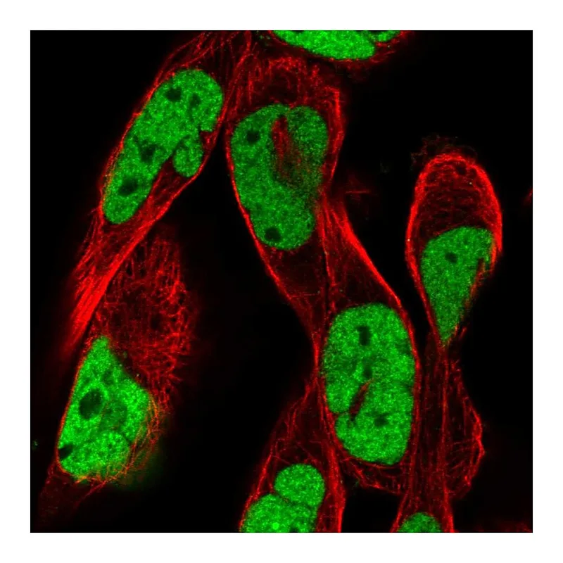 Atlas Antibodies Anti-RSF1 Antibody