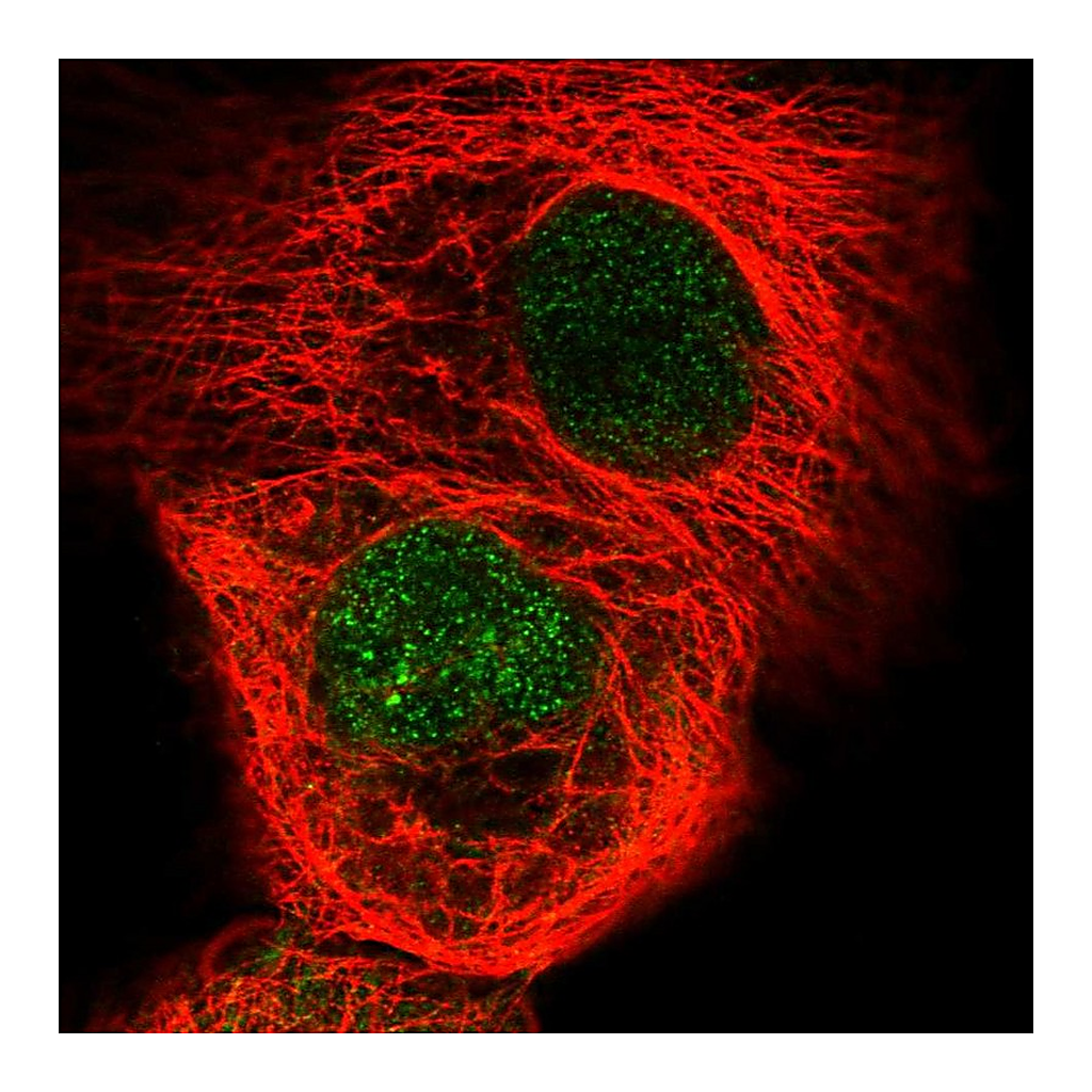 Atlas Antibodies Anti-RSG1 Antibody