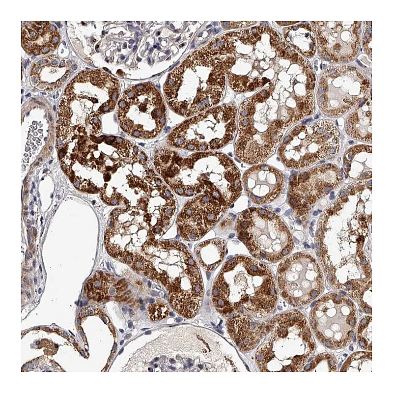 Atlas Antibodies Anti-RSC1A1 Antibody