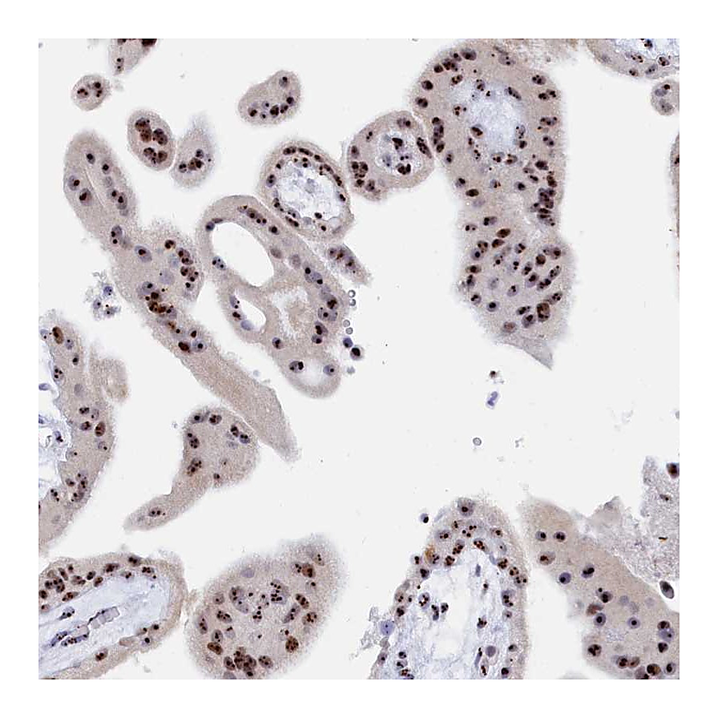 Atlas Antibodies Anti-RSL1D1 Antibody