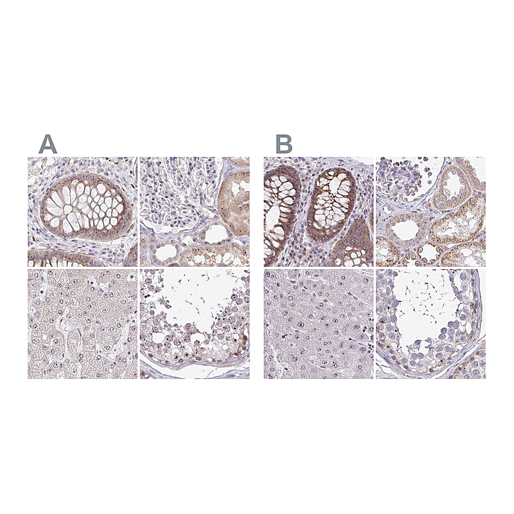 Atlas Antibodies Anti-RSL24D1 Antibody