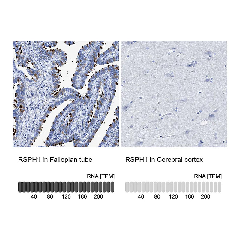 Atlas Antibodies Anti-RSPH1 Antibody