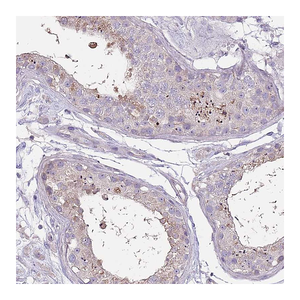 Atlas Antibodies Anti-RSPH10B Antibody