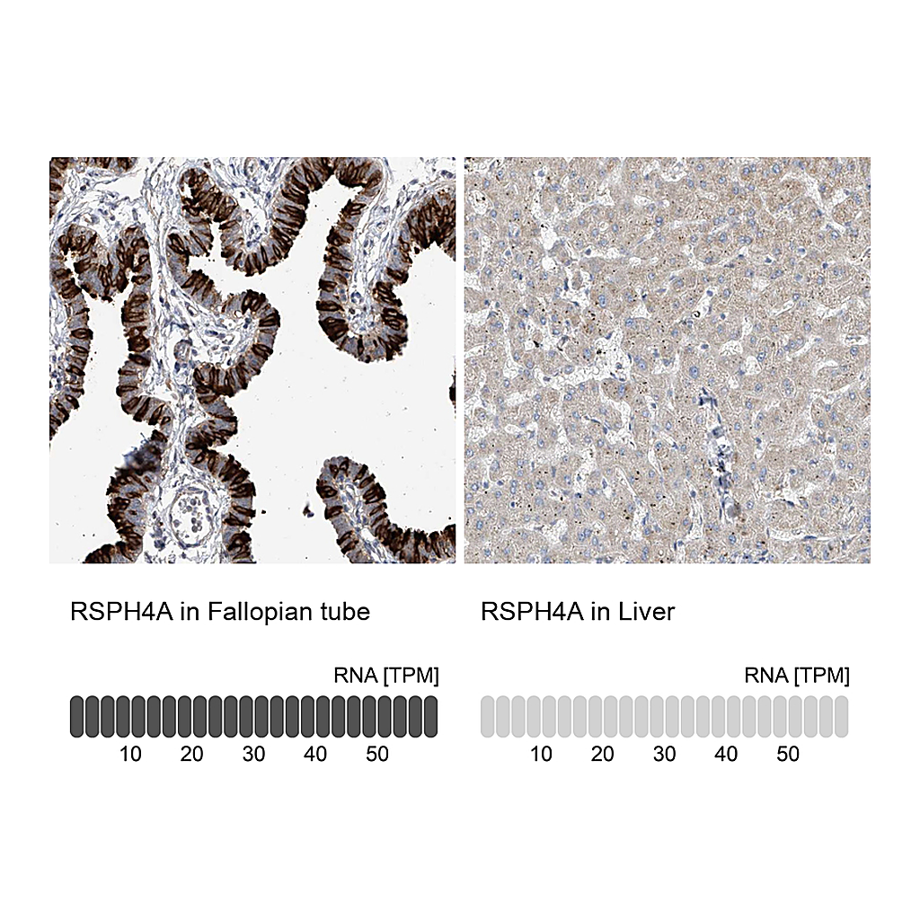 Atlas Antibodies Anti-RSPH4A Antibody