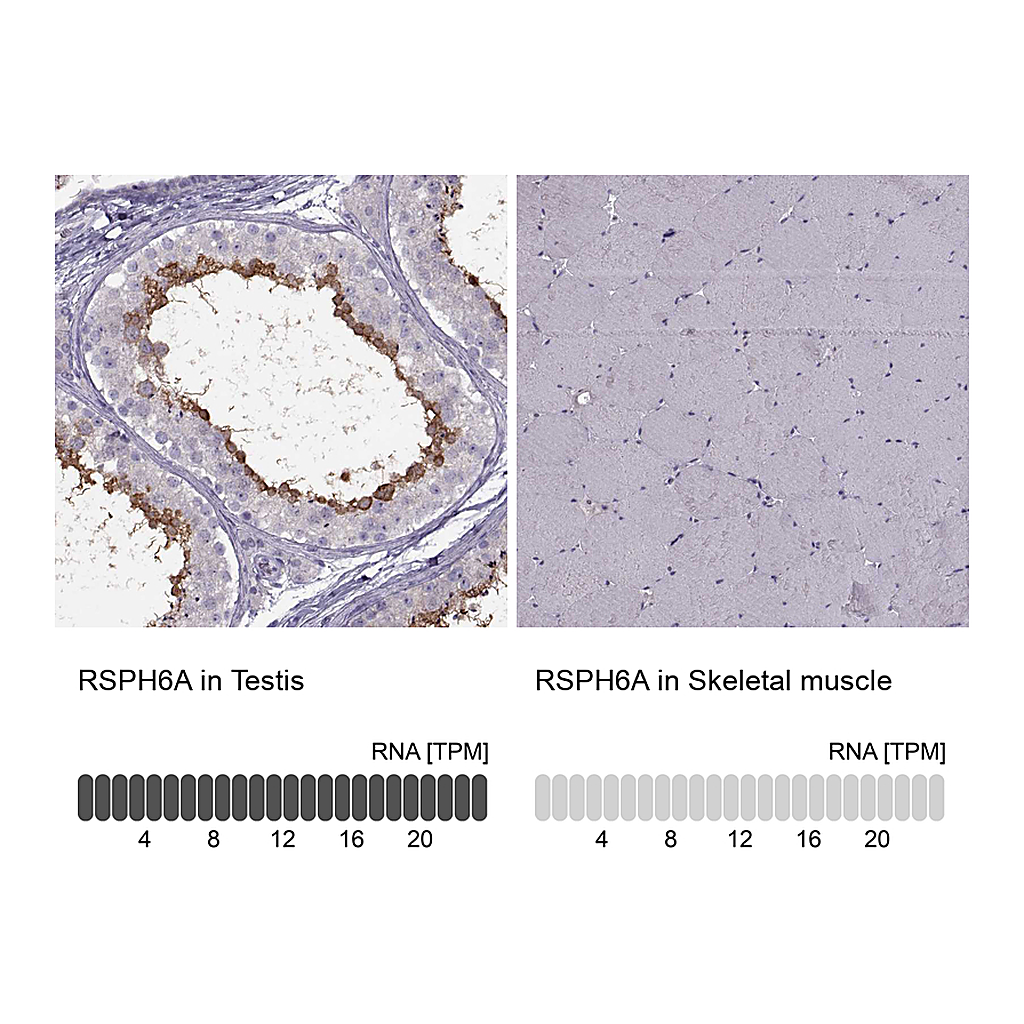 Atlas Antibodies Anti-RSPH6A Antibody