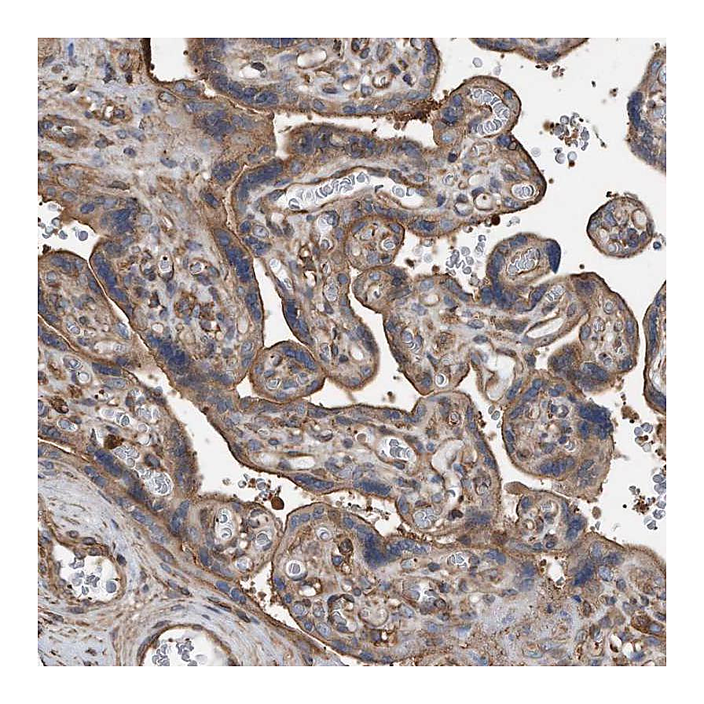 Atlas Antibodies Anti-RSPO3 Antibody