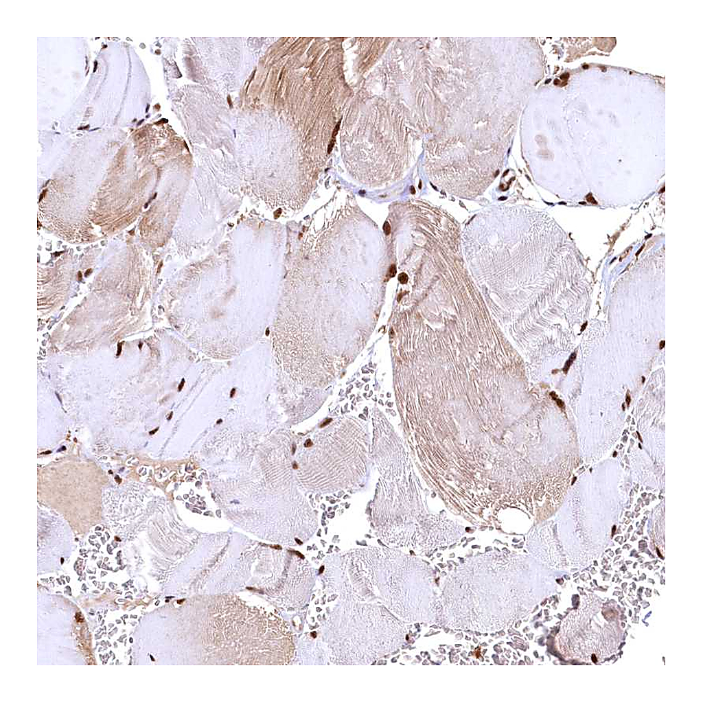Atlas Antibodies Anti-RSRC2 Antibody
