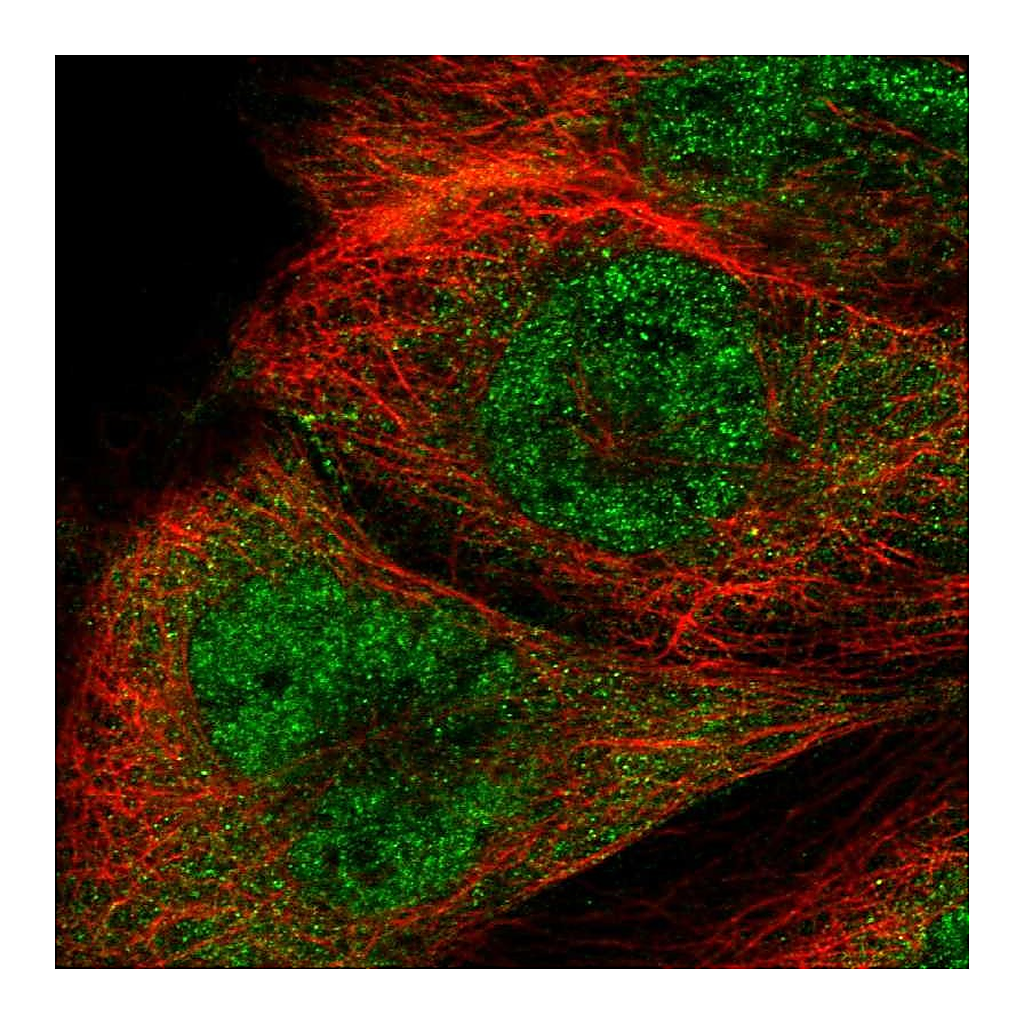 Atlas Antibodies Anti-RTCB Antibody