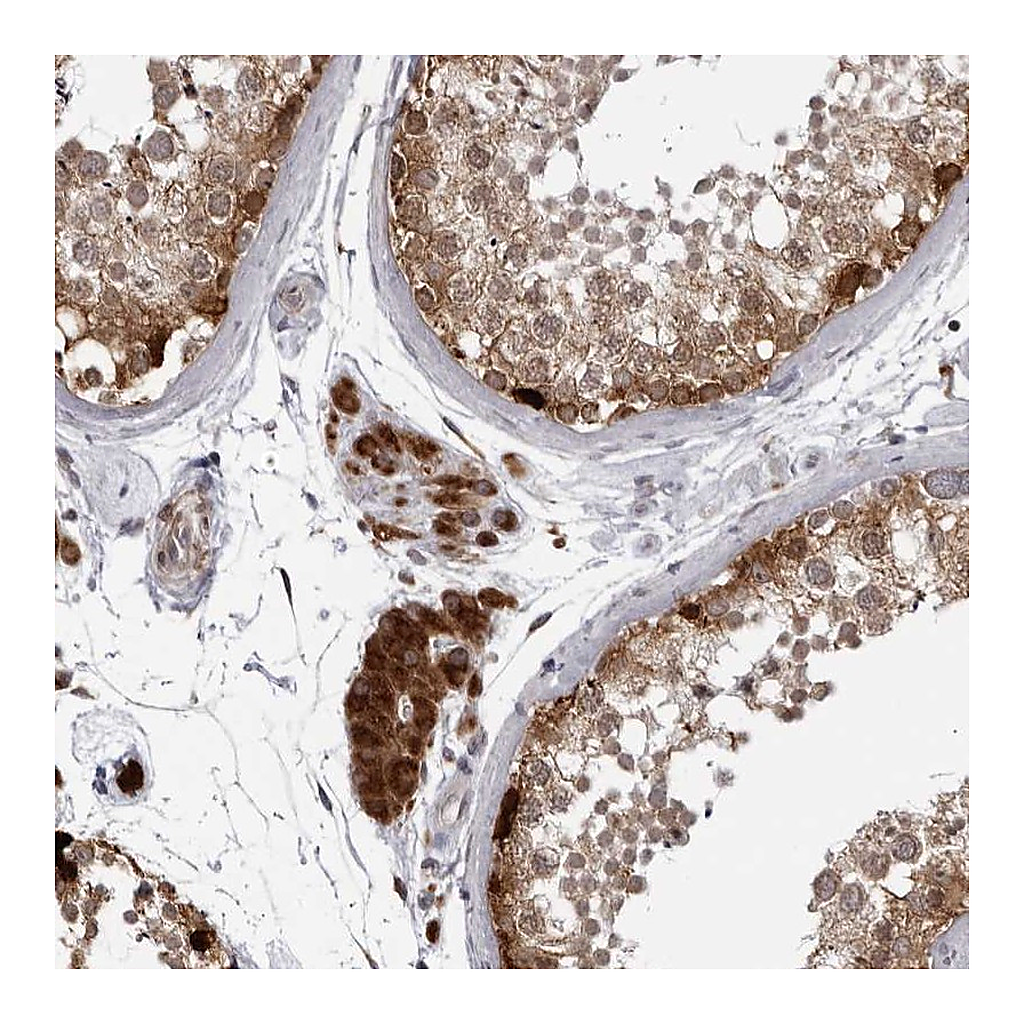 Atlas Antibodies Anti-RTCA Antibody
