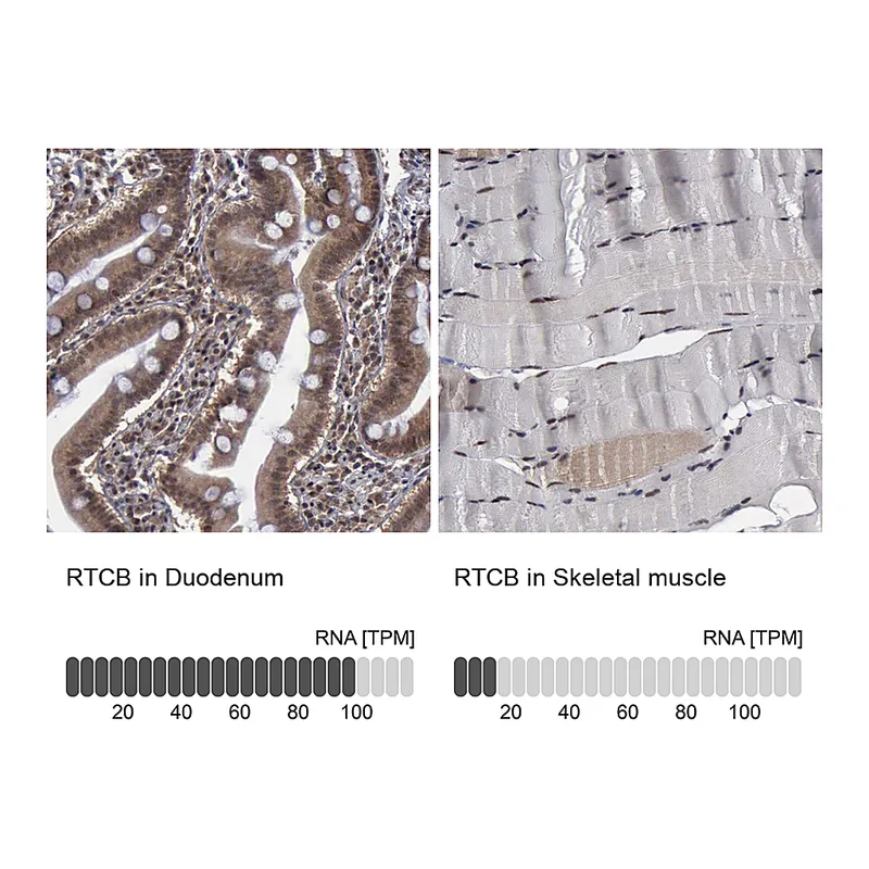 Atlas Antibodies Anti-RTCB Antibody