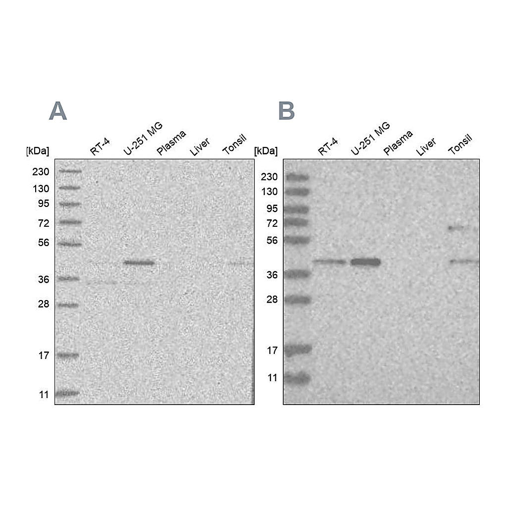 Atlas Antibodies Anti-RTCA Antibody
