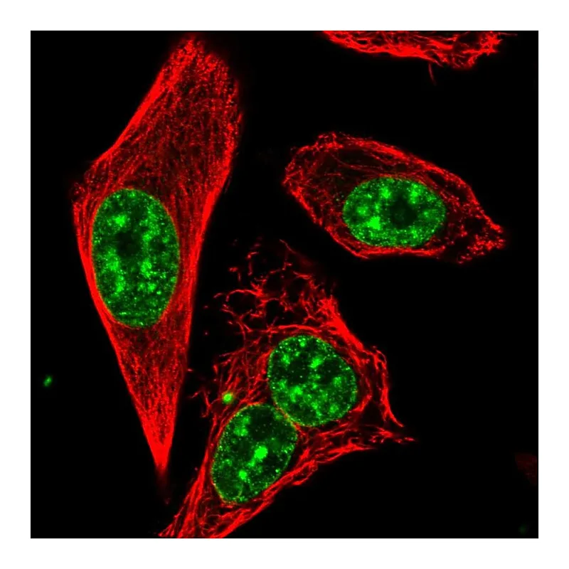 Atlas Antibodies Anti-RTEL1 Antibody