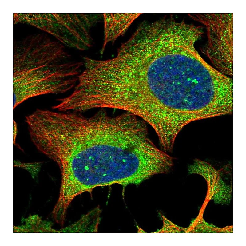 Atlas Antibodies Anti-RTN1 Antibody