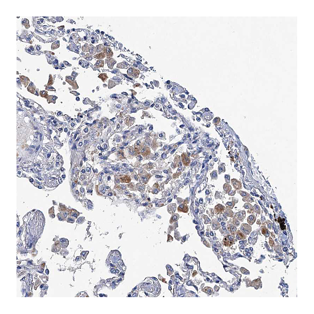 Atlas Antibodies Anti-RTKN2 Antibody