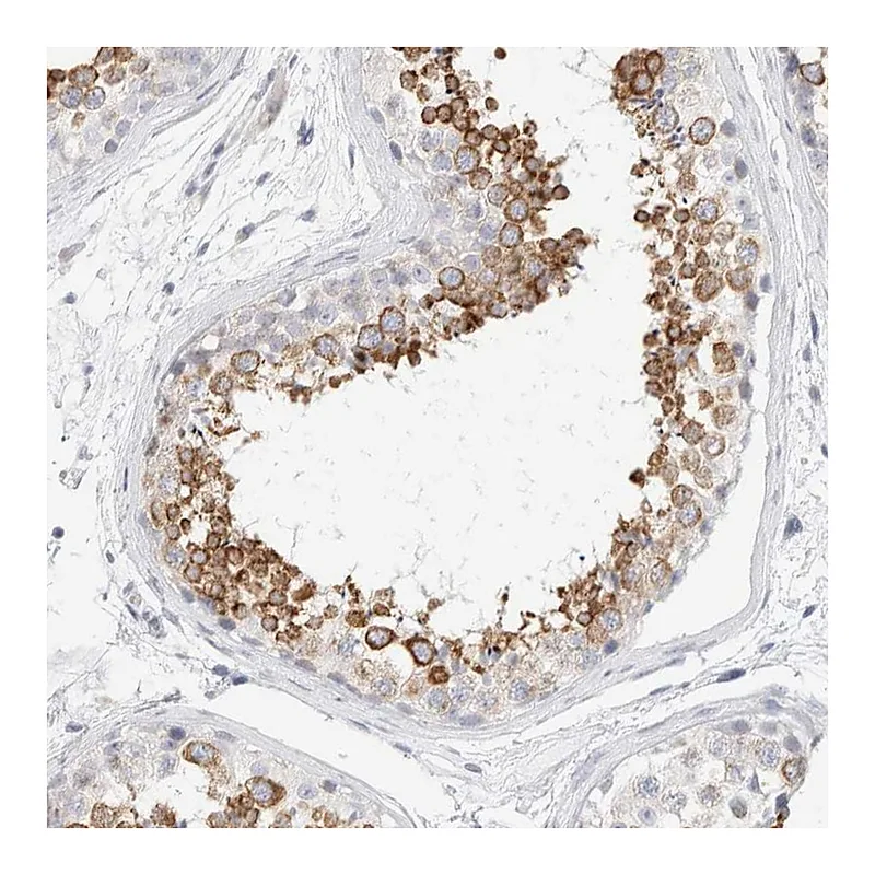 Atlas Antibodies Anti-RTN4 Antibody