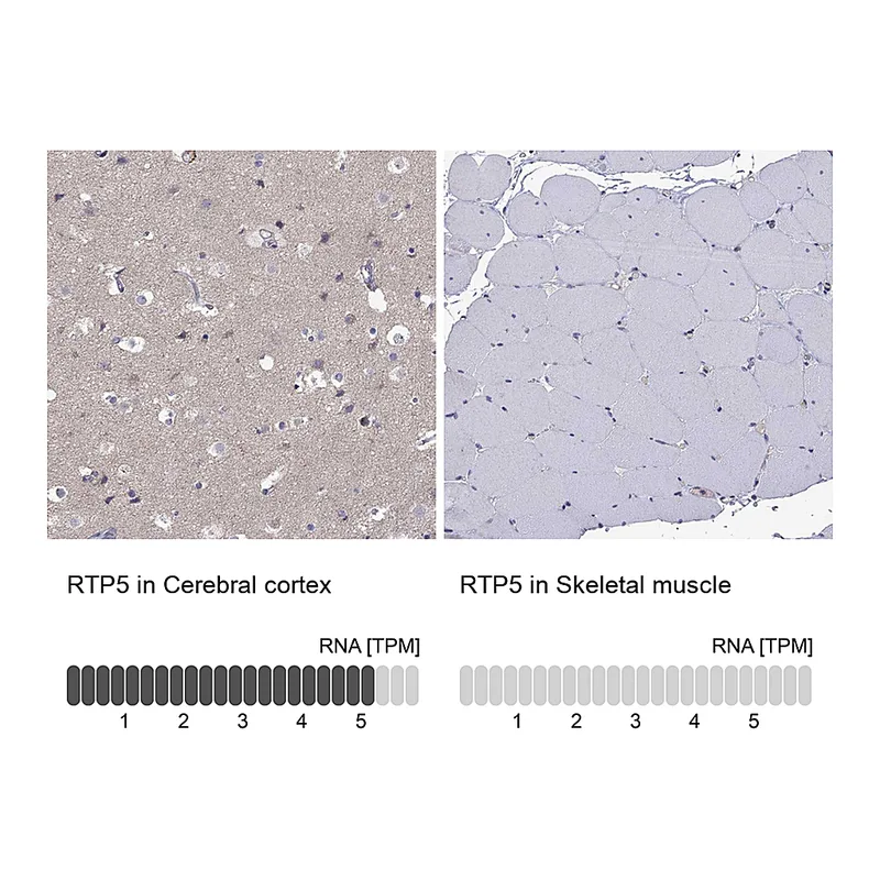 Atlas Antibodies Anti-RTP5 Antibody