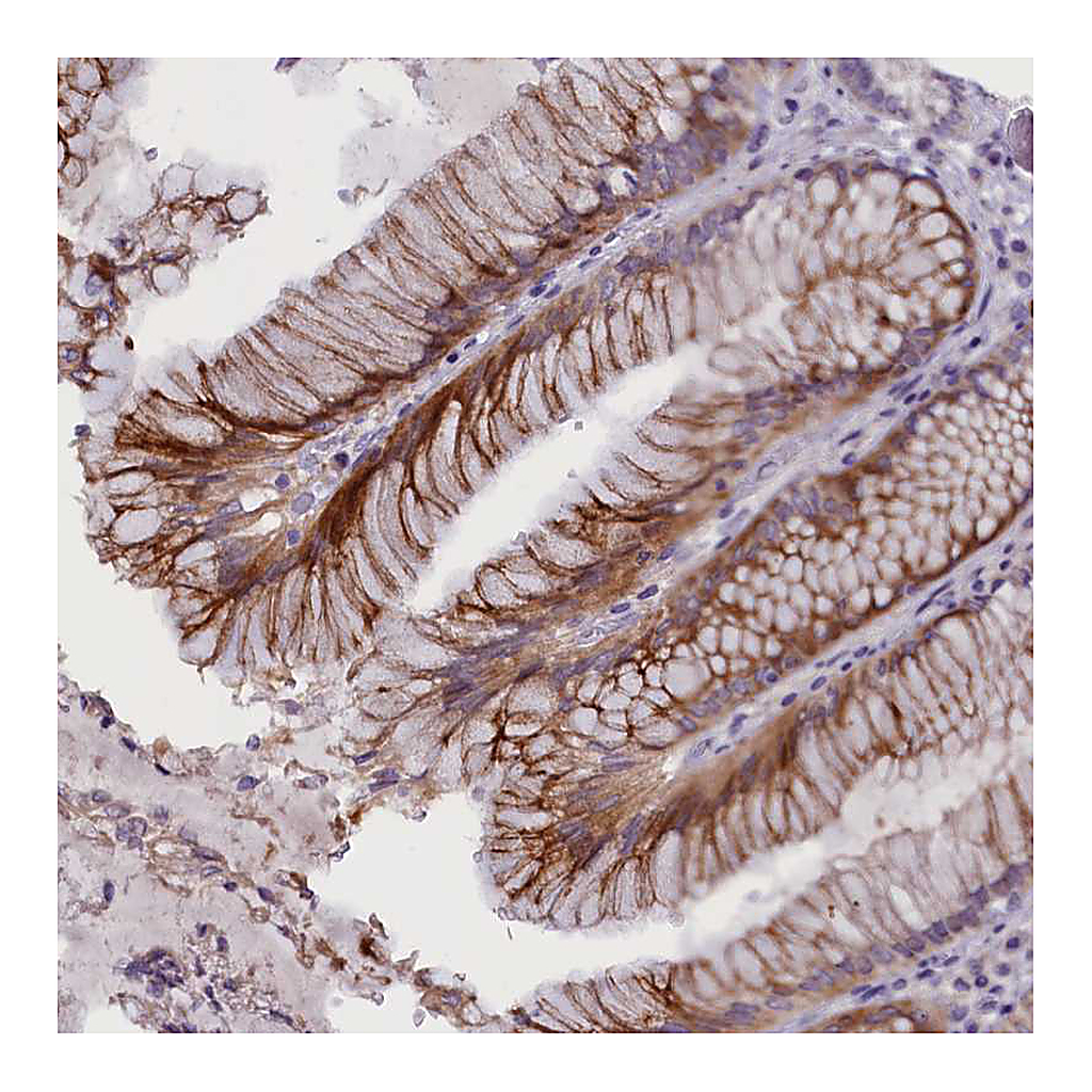 Atlas Antibodies Anti-RTTN Antibody