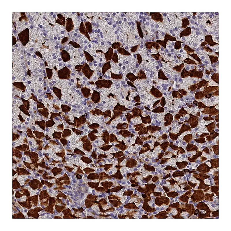 Atlas Antibodies Anti-RTTN Antibody