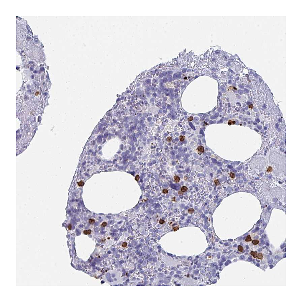 Atlas Antibodies Anti-RUBCN Antibody