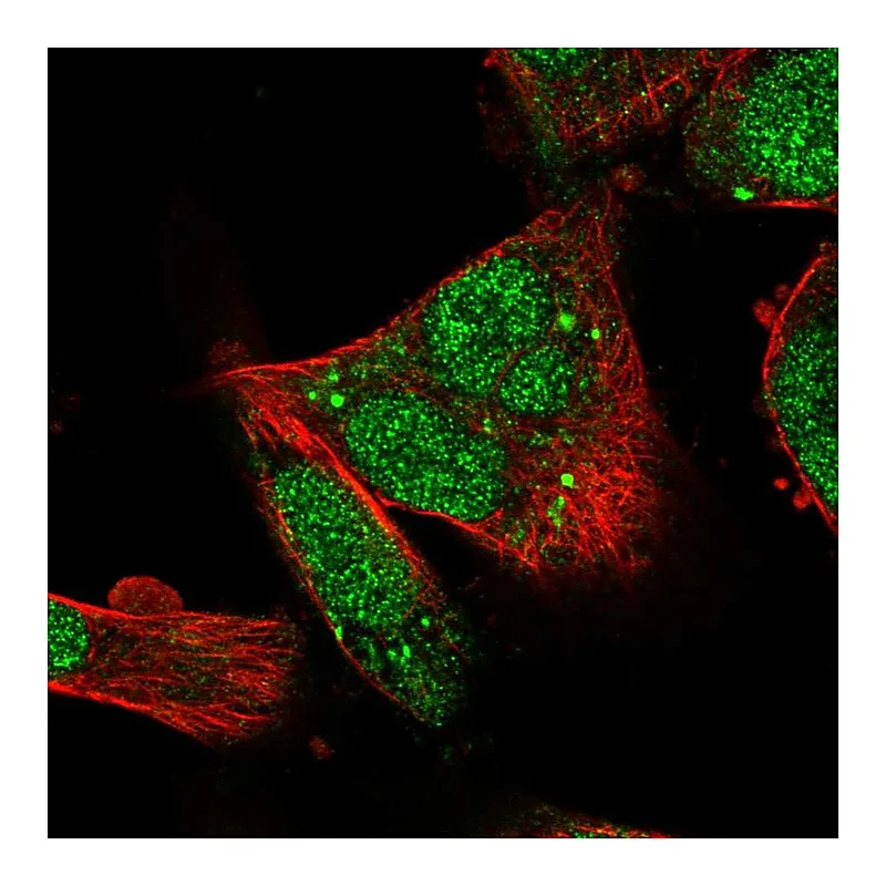 Atlas Antibodies Anti-RUFY1 Antibody