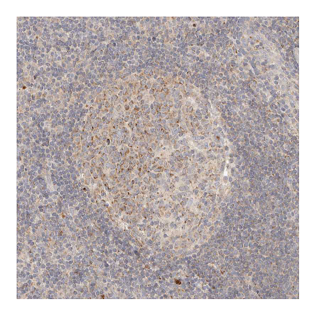 Atlas Antibodies Anti-RUBCNL Antibody