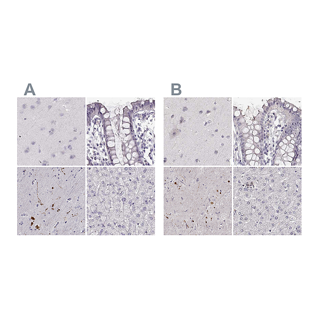 Atlas Antibodies Anti-RUNDC3A Antibody